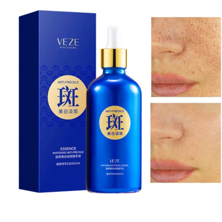 سرم ضد لک وزه مدل نیاسینیوم حجم 100 میلی لیتر