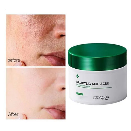 کرم ژل ضد جوش سالیسیلیک اسید بیوآکوا حجم 120 گرم