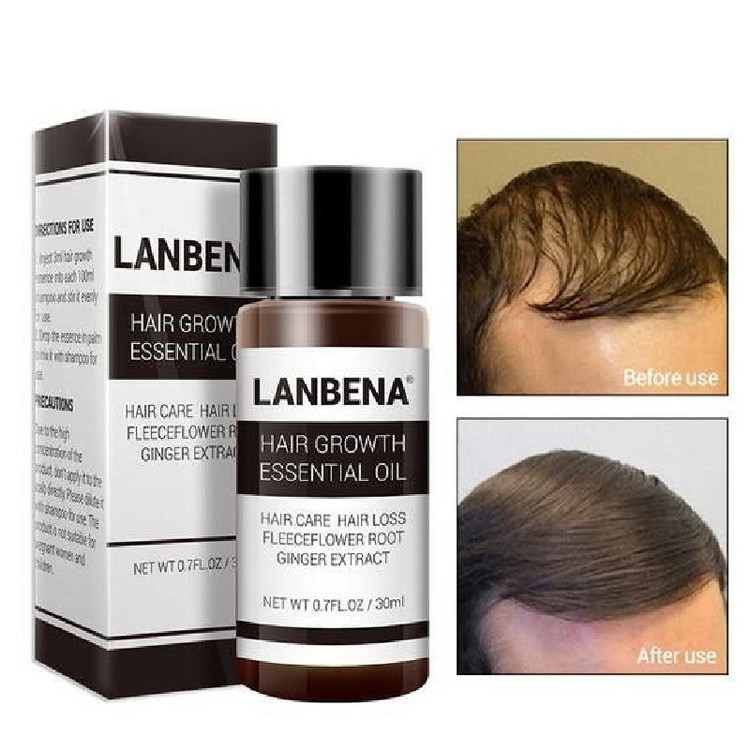 سرم تقویت مو لانبنا حجم 20 میلی لیتر