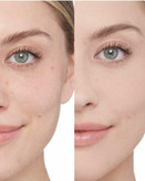 کانسیلر 24 ساعته پددار آرت اسکین حجم 11.5 گرم